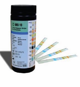 Quy thử nước tiểu